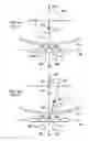 Fig. 06 - Apparatus and method using near infrared reflectometry to reduce the effect of positional changes during spinal cord stimulation