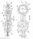 Fig. 07 - Surgical method for implantable head mounted neurostimulation system for head pain