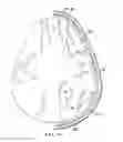 Fig. 23 - Surgical method for implantable head mounted neurostimulation system for head pain