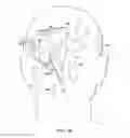 Fig. 32 - Surgical method for implantable head mounted neurostimulation system for head pain