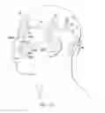 Fig. 33 - Surgical method for implantable head mounted neurostimulation system for head pain