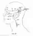Fig. 46 - Surgical method for implantable head mounted neurostimulation system for head pain
