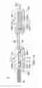 Fig. 59 - Surgical method for implantable head mounted neurostimulation system for head pain