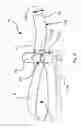 Fig. 02 - Strap wrench