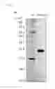Fig. 02 - Methods of utilizing thermostable mismatch endonuclease