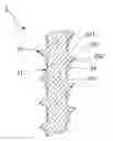 Fig. 01 - FASTENER