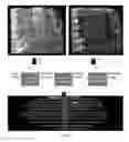 Fig. 02 - Cinematic rendering of unfolded 3D volumes