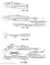 Fig. 06 - Speech Recognition
