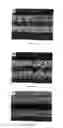 Fig. 09 - METHOD FOR MANUFACTURING A MINIATURIZED ELECTROCHEMICAL CELL AND A MINIATURIZED ELECTROCHEMICAL CELL