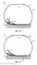 Fig. 22 - Footwear arch support