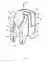 Fig. 02 - Detachable bag