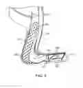Fig. 10 - Thermoplastic chair flexor