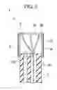 Fig. 06 - ENDOSCOPE ATTACHMENT