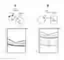 Fig. 01 - Method and system for motion artefacts removal in optical coherence tomography