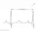 Fig. 01 - Streaming updates of central moments for heart rate variability quantification