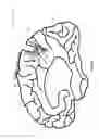 Fig. 06 - IMPROVED METHODS AND APPARATUS FOR CORTICAL STIMULATION MAPPING DURING SURGICAL PROCEDURES