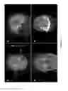 Fig. 23 - IMPROVED METHODS AND APPARATUS FOR CORTICAL STIMULATION MAPPING DURING SURGICAL PROCEDURES