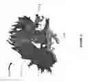 Fig. 32 - IMPROVED METHODS AND APPARATUS FOR CORTICAL STIMULATION MAPPING DURING SURGICAL PROCEDURES