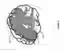 Fig. 33 - IMPROVED METHODS AND APPARATUS FOR CORTICAL STIMULATION MAPPING DURING SURGICAL PROCEDURES