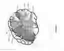 Fig. 34 - IMPROVED METHODS AND APPARATUS FOR CORTICAL STIMULATION MAPPING DURING SURGICAL PROCEDURES