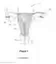Fig. 02 - Apparatus and Processes for Operating on a Narrow Body Lumen