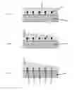 Fig. 02 - Coated Biosensor and Method for Preserving Biosensor During Implantation into the Brain or Other Tissues