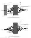 Fig. 04 - SYNCHRONIZED MULTI-MODULE PULSED ARTERIAL SPIN LABELED MAGNETIC RESONANCE IMAGING