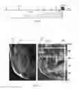 Fig. 07 - SYNCHRONIZED MULTI-MODULE PULSED ARTERIAL SPIN LABELED MAGNETIC RESONANCE IMAGING