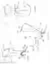 Fig. 07 - Minimally open retraction device