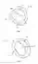 Fig. 02 - Method and apparatus for transapical procedures on a mitral valve