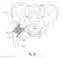 Fig. 16 - Anatomical concentric spheres THA