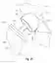 Fig. 20 - Anatomical concentric spheres THA
