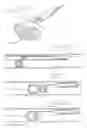 Fig. 07 - Endoscopic stone-extraction device