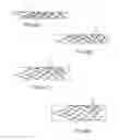 Fig. 05 - Galvanically assisted attachment of medical devices to thrombus