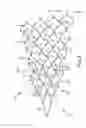 Fig. 09 - Galvanically assisted attachment of medical devices to thrombus