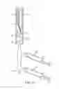 Fig. 16 - Galvanically assisted attachment of medical devices to thrombus