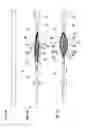 Fig. 04 - Medical device for cutting substances inside a body lumen