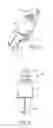 Fig. 02 - Interspinous spacer