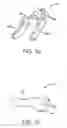 Fig. 06 - Interspinous spacer