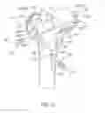 Fig. 06 - Patient-specific fracture fixation instrumentation and method