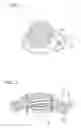 Fig. 02 - Endoscopic treatment tool