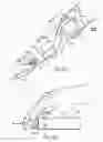 Fig. 22 - Catheter apparatuses, systems, and methods for renal neuromodulation