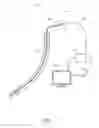 Fig. 02 - Distal airway cleaning devices