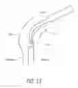 Fig. 22 - Distal airway cleaning devices