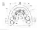 Fig. 01 - Removable orthodontic correction device
