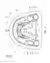 Fig. 05 - Removable orthodontic correction device