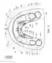 Fig. 06 - Removable orthodontic correction device