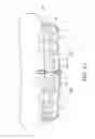 Fig. 07 - Removable orthodontic correction device