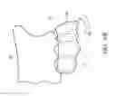 Fig. 08 - Removable orthodontic correction device