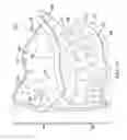 Fig. 02 - Dental impression tray system and methods of use thereof